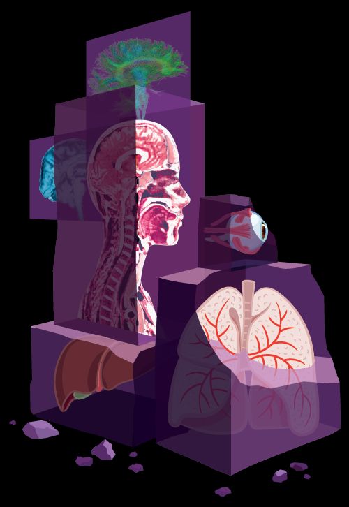 Depiction of medical scans being extracted from rock